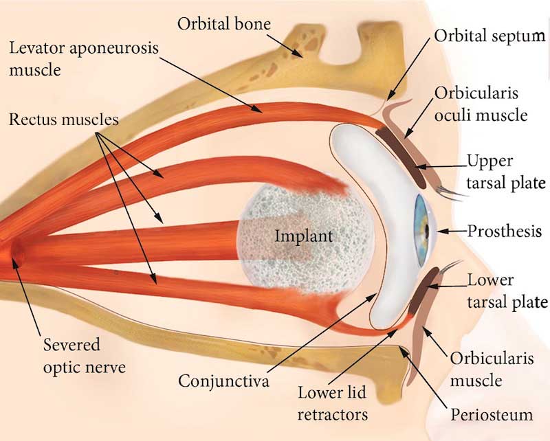 Socket Anatomy New Zealand Prosthetic Eye Service