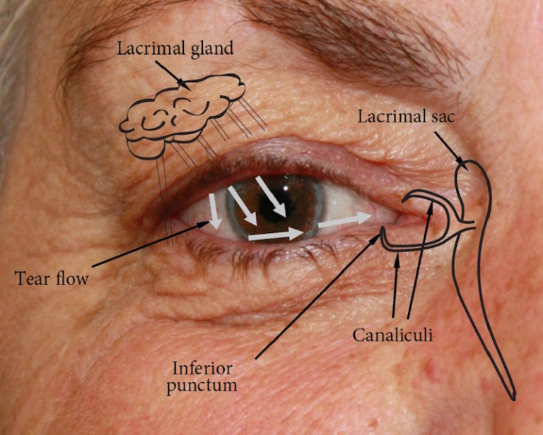 Socket anatomy New Zealand Prosthetic Eye Service