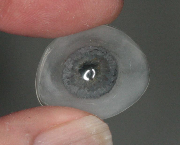 Scleral Shells New Zealand Prosthetic Eye Service